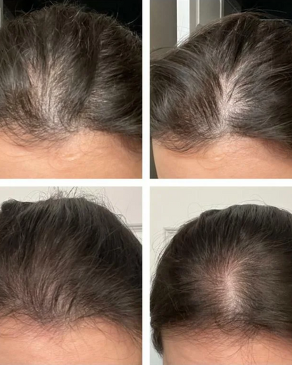 The Ordinary Multi-Peptide Serum for Hair Density | Recupera la densidad de tu cabello sin tratamientos invasivos.