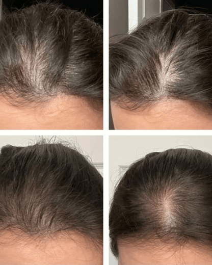 The Ordinary Multi - Peptide Serum for Hair Density | Recupera la densidad de tu cabello sin tratamientos invasivos. - GlobalyShop